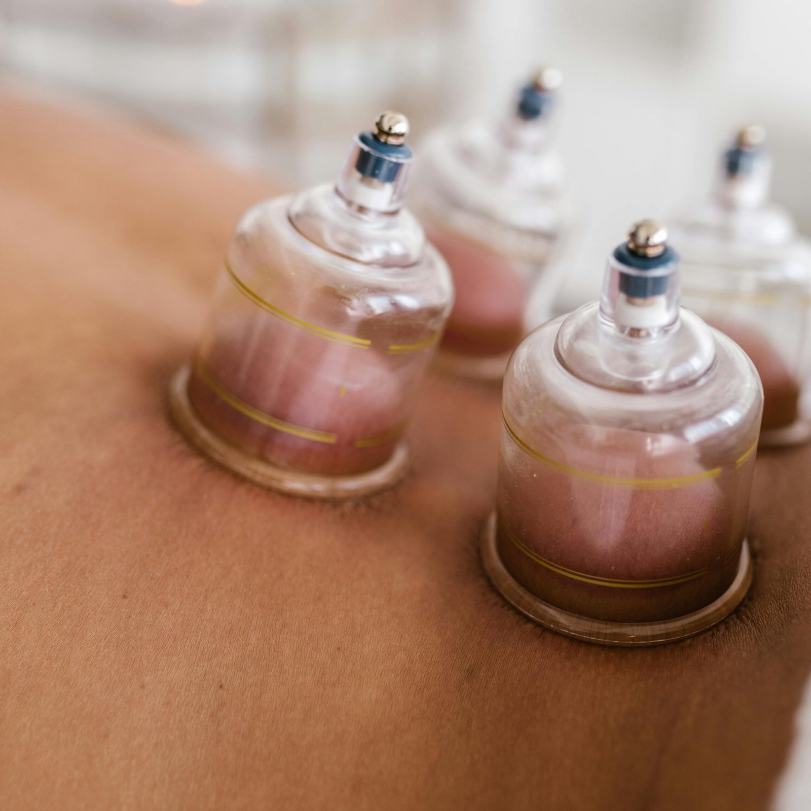 Cupping Therapy